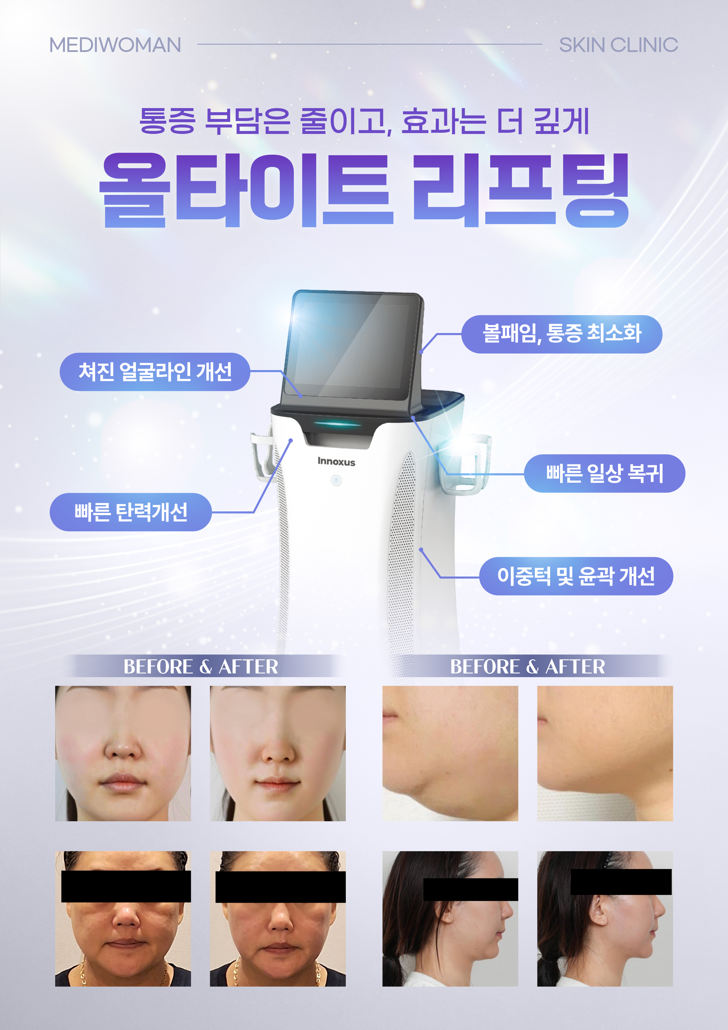 특허기술 적용 [올타이트 리프팅]